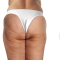 Non Surgical Liposuction: A Revolutionary Treatment for Cellulite