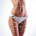 Non Surgical Liposuction: A Safe and Effective Option for All Skin Types