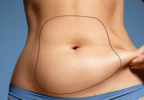 How much does liposuction cost in the uk?