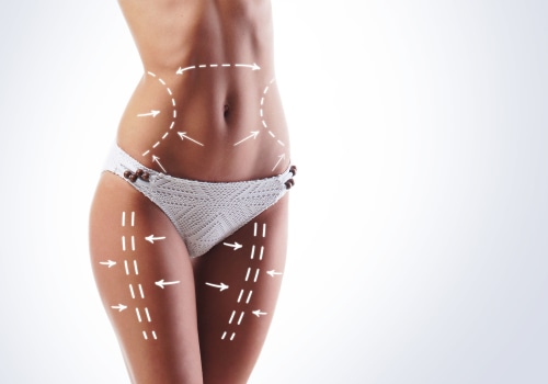 Non Surgical Liposuction: A Safe and Effective Option for All Skin Types